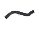 DT Spare Parts - Radiator hose - 2.15117