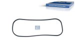 DT Spare Parts - Gasket - 2.24211 - 10 Pack