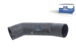 DT Spare Parts - Radiator hose - 1.00152