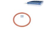 DT Spare Parts - O-ring - 4.20886 - 5 Pack