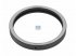 DT Spare Parts - Spacer ring - 1.14499 - 2 Pack